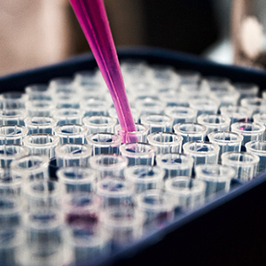 louis-reed-pwcKF7L4-no-unsplash